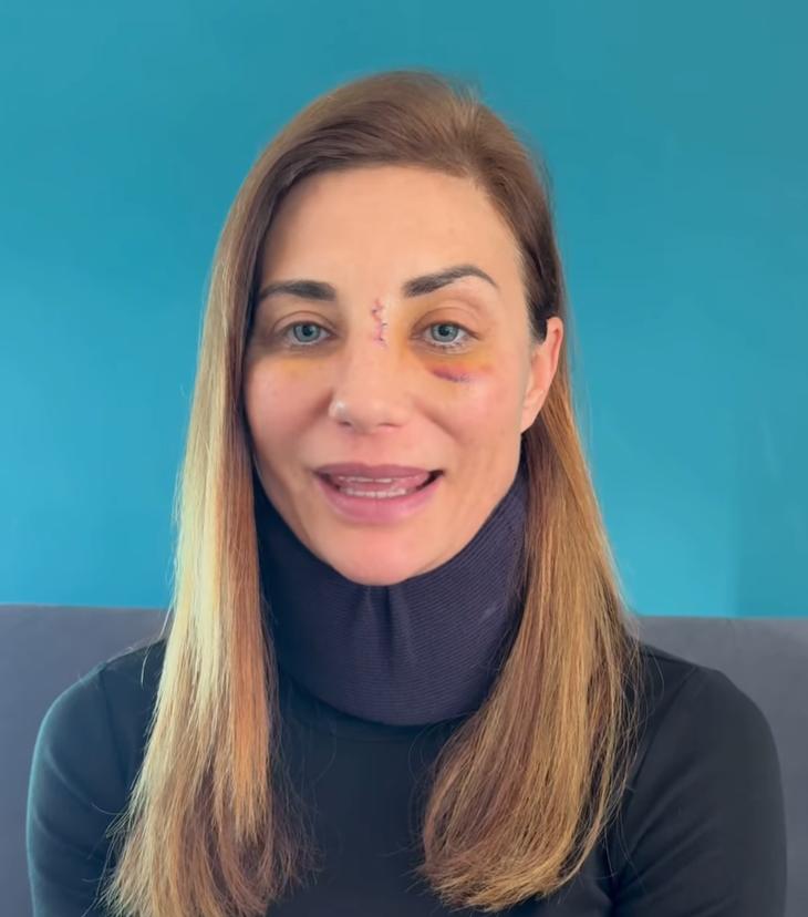Ariane Brodier brise le silence après une violente agression : un témoignage bouleversant