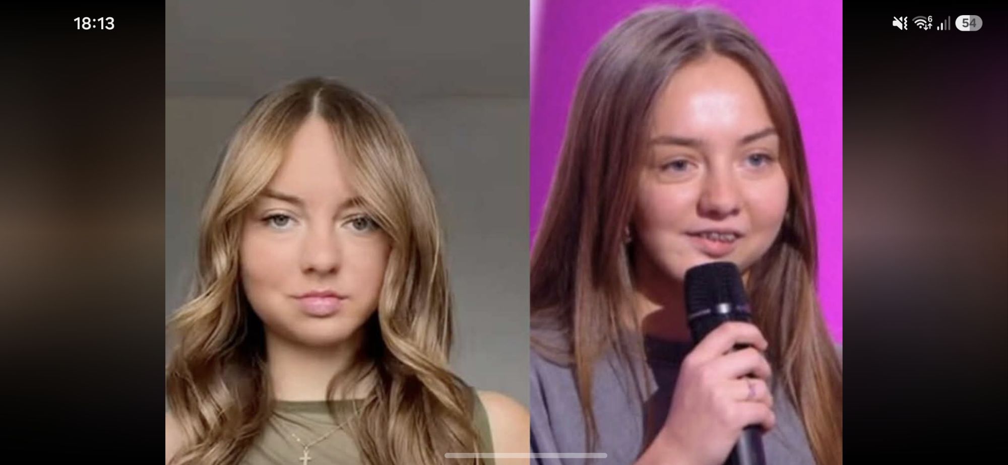 À 16 ans, Charlotte Deseigne, gagnante de The Voice Kids dévoile le résultat de son opération du visage et bouleverse ses fans