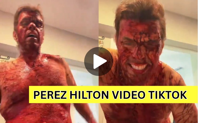 Perez Hilton hospitalisé après un direct inquiétant : Les autorités privilégient une prise en charge médicale